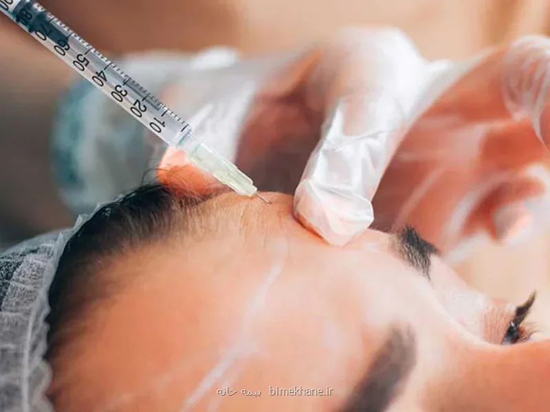 تزریق بوتاکس و مزایای آن